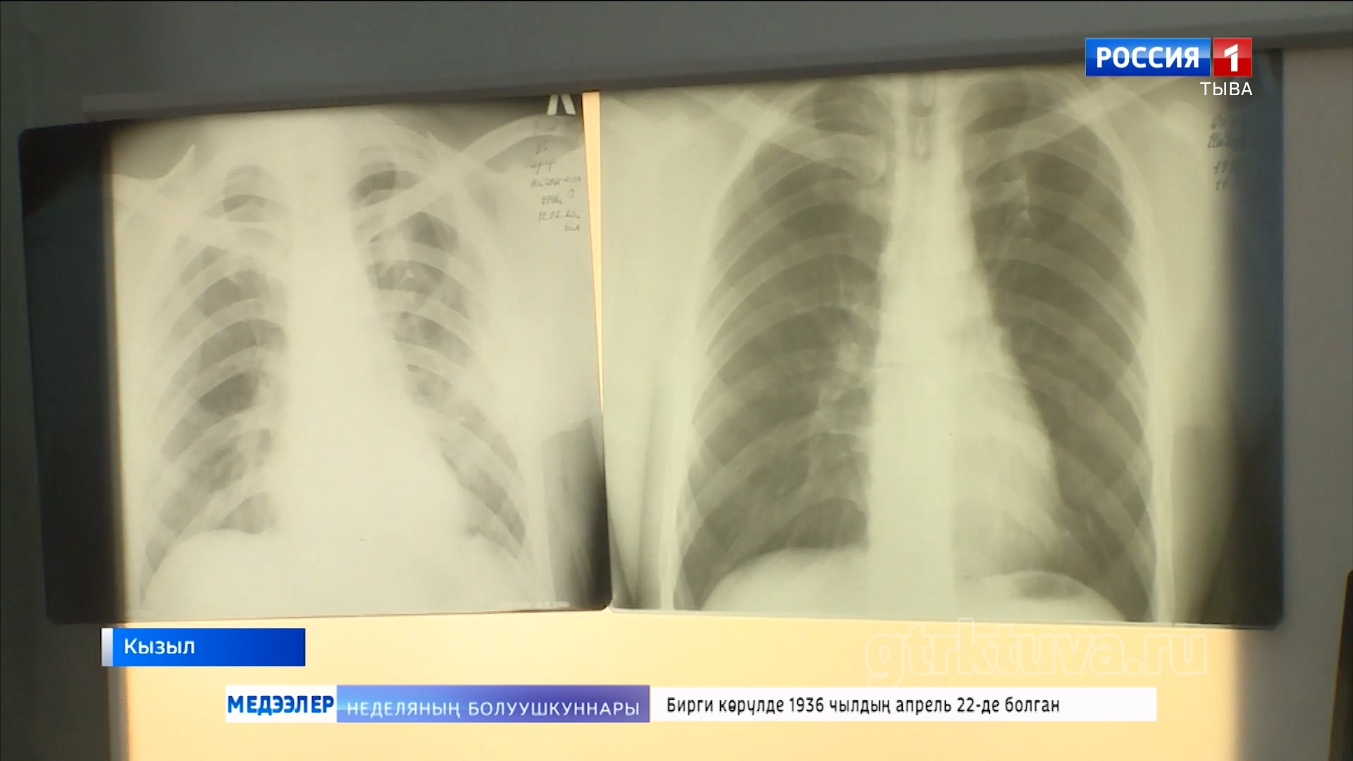 Өкпе аарыынга удур демисел