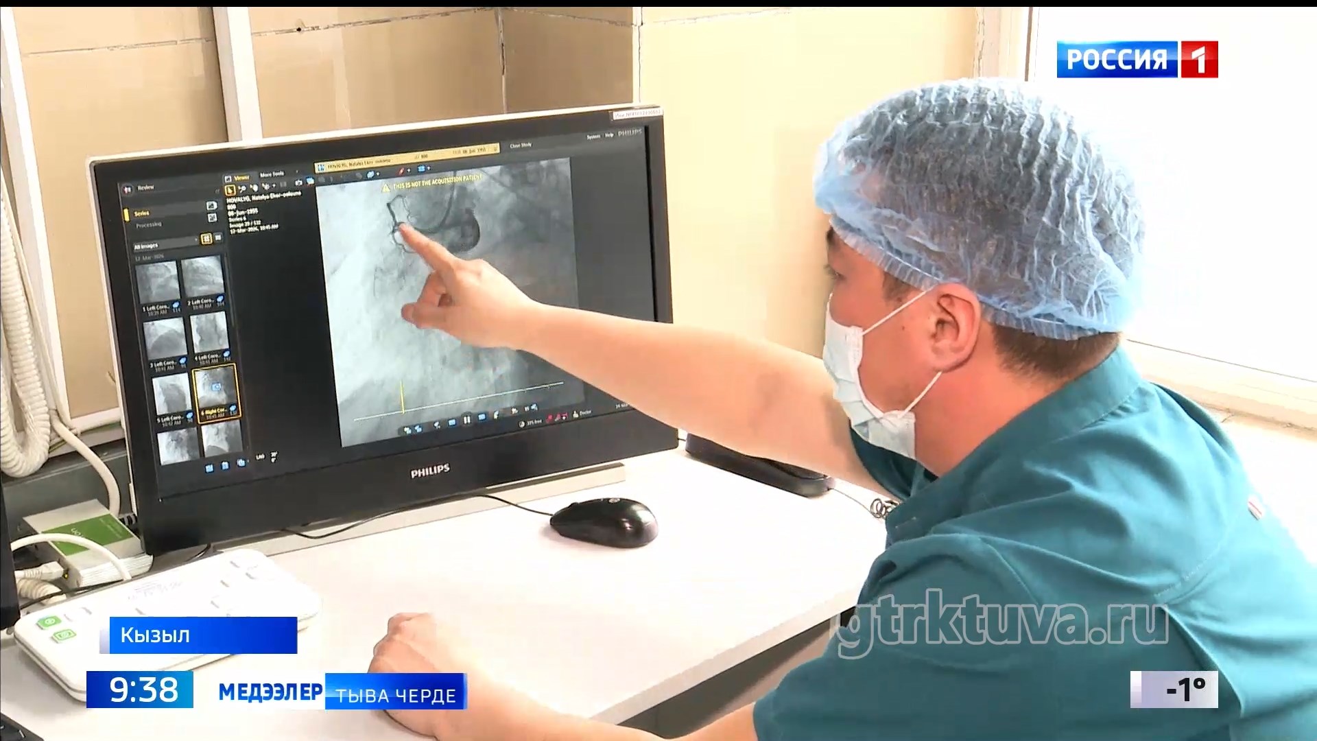 Кадык чүрек - узун назын